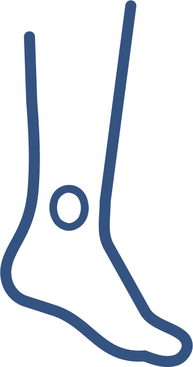 úlceras 2